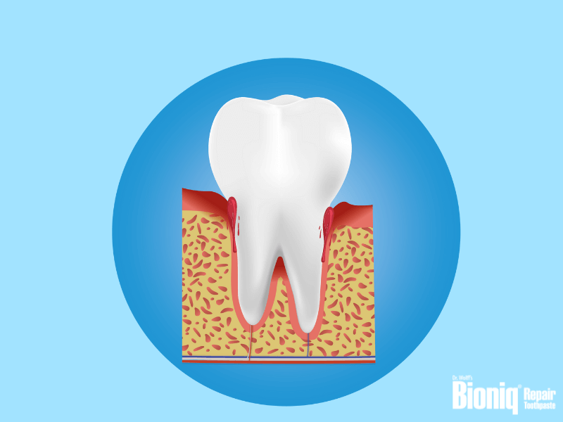 牙齦出血：如何讓牙齦保持健康？